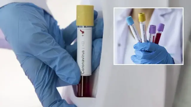 zayiflar kovid 19u daha agir geciriyor wnNV4ZkR.webp